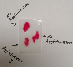 Agglutination